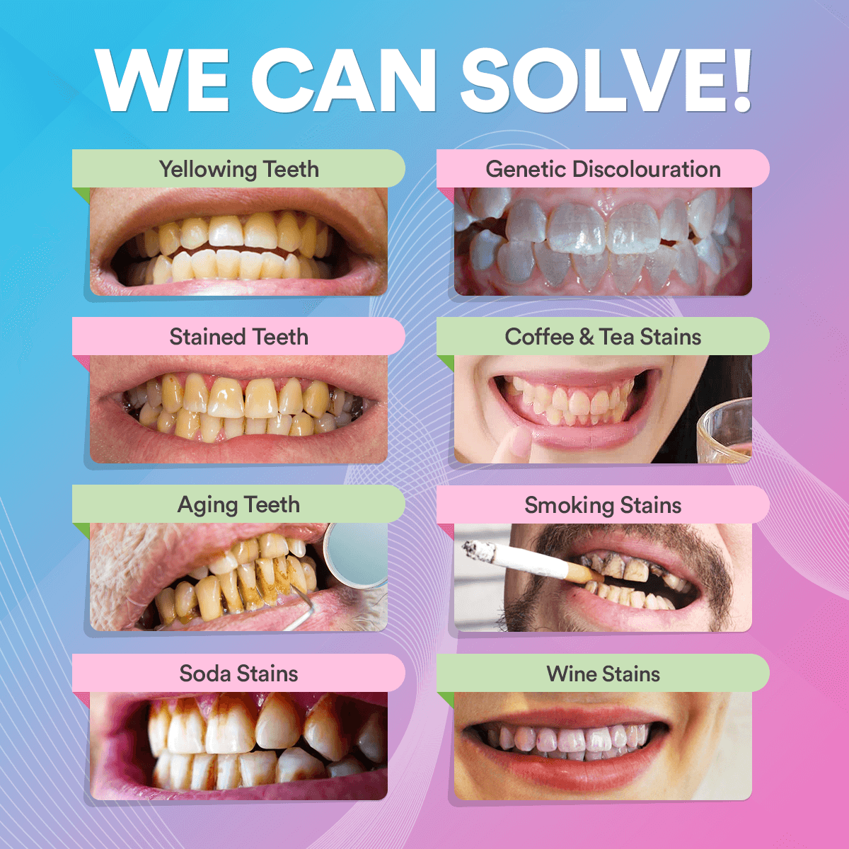 Teeth Whitening Pen DP9