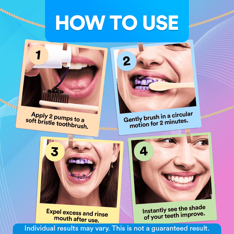 V34 Colour Corrector for Teeth: Cancels Yellow Tones, Safe Enamel Whitening, Easy Use, Dental Cosmetic Perfection DP7
