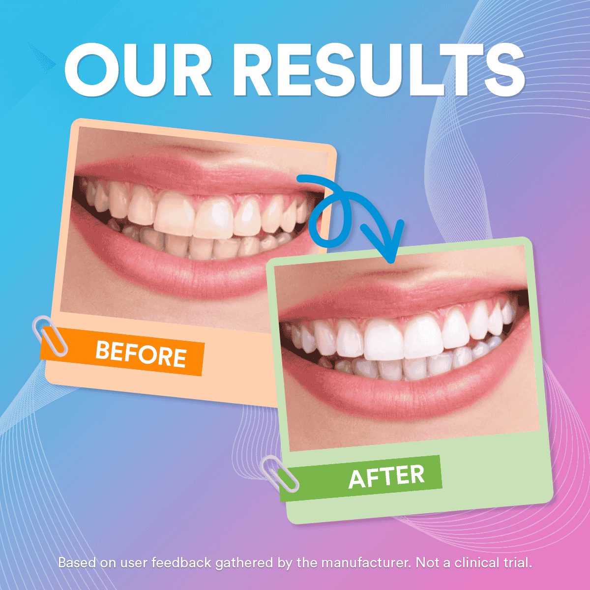 V34 Colour Corrector for Teeth: Cancels Yellow Tones, Safe Enamel Whitening, Easy Use, Dental Cosmetic Perfection DP7