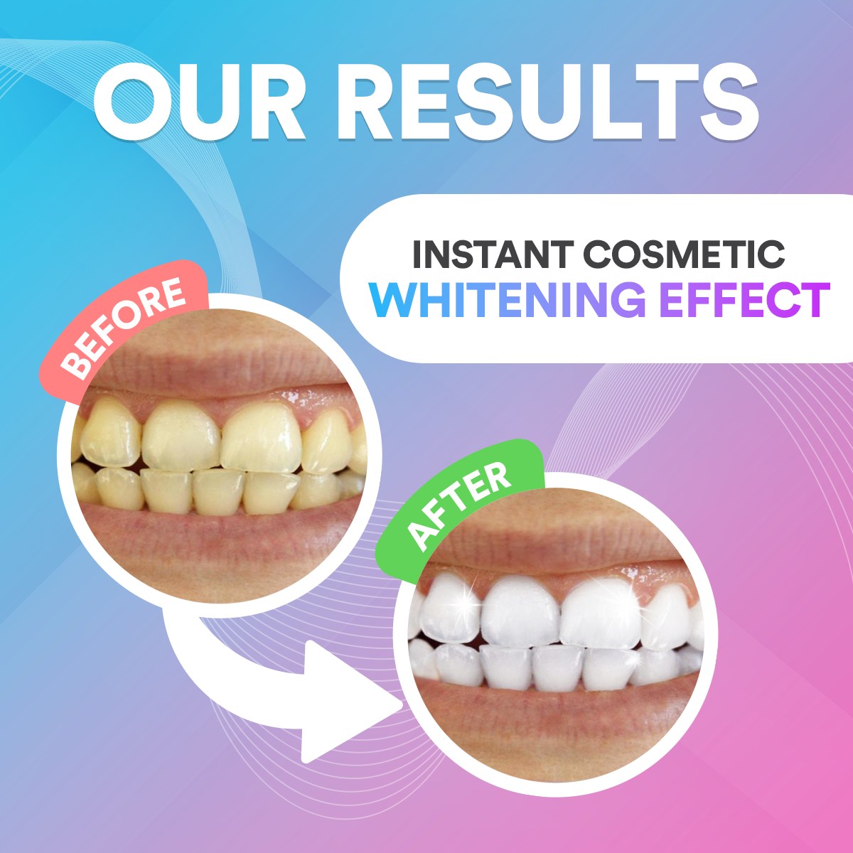 Teeth Whitening Pen DP2D