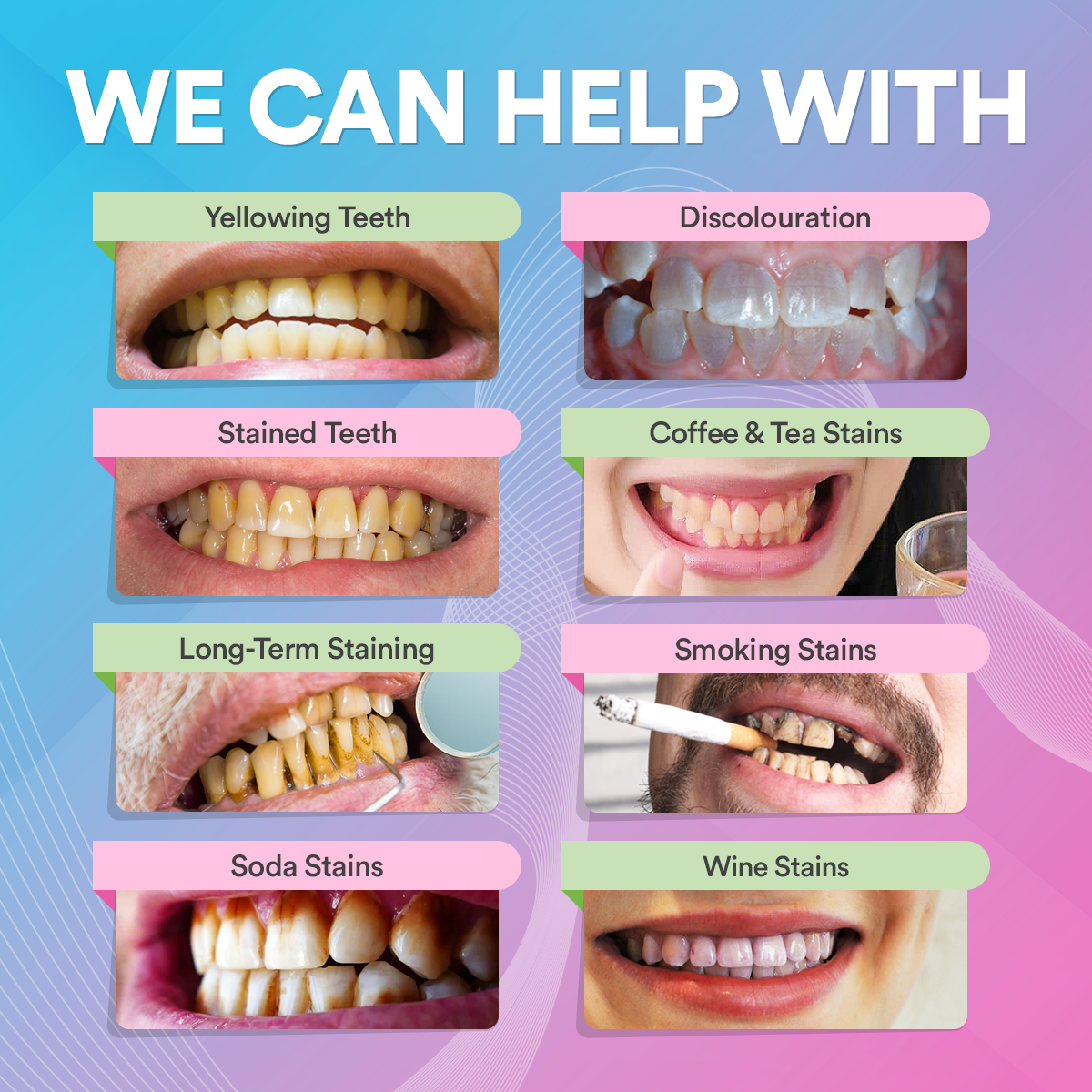 Teeth Whitening Pen DP2D