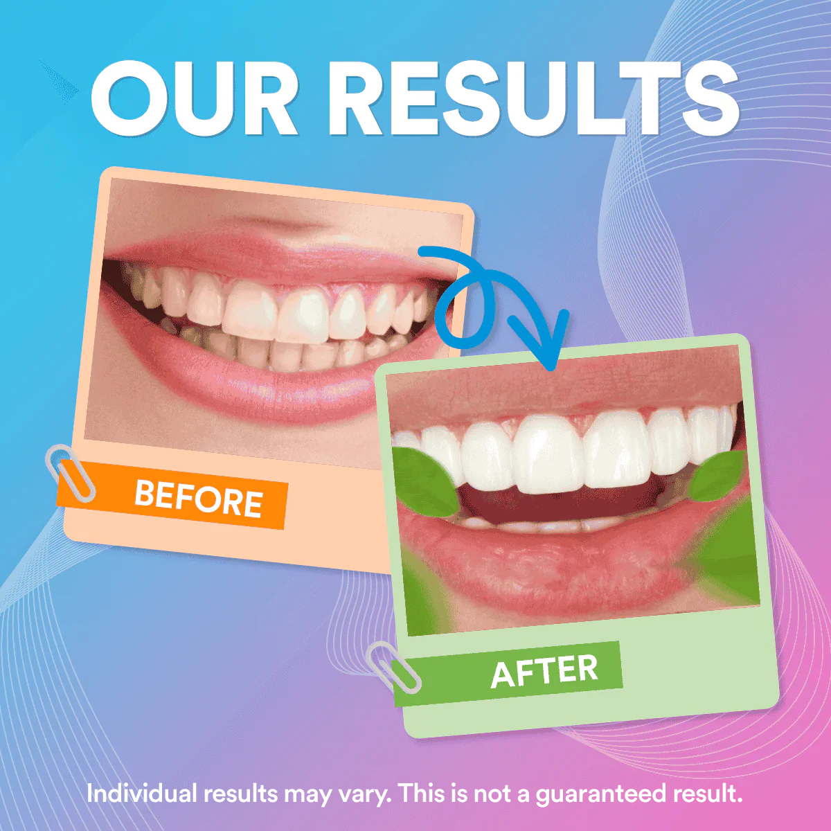Flavoured Toothpaste DP6