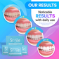 Teeth Cleaning & Whitening Strips (14 Treatments) DP8