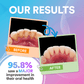 Dental Wireless 4 in 1 Water Flosser DP2