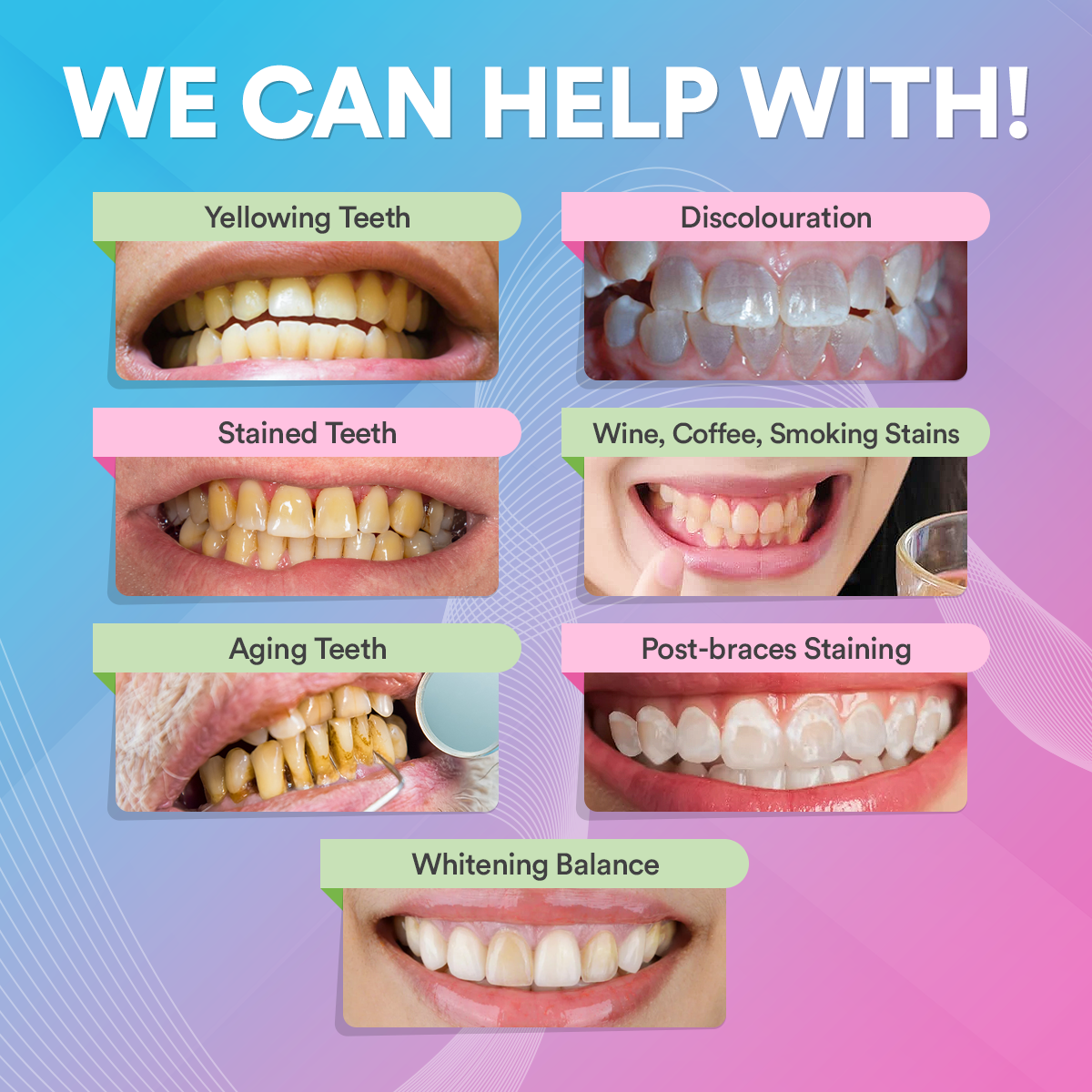 PAP+ Pro Teeth Whitening Powder DP14