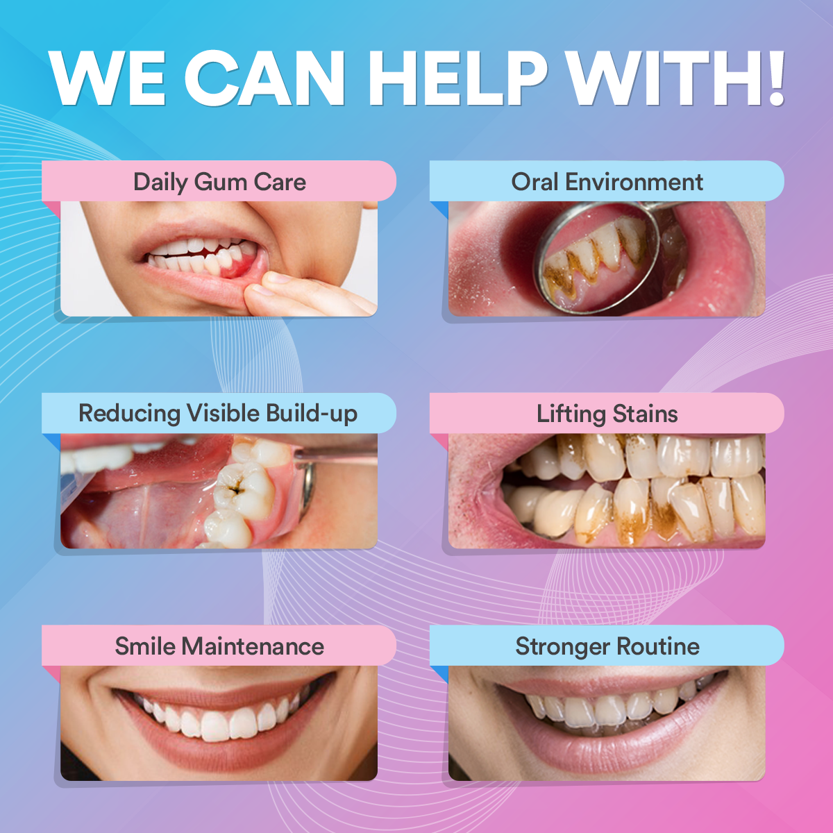 Ultrasonic Tooth Cleaner *BEST SELLER*