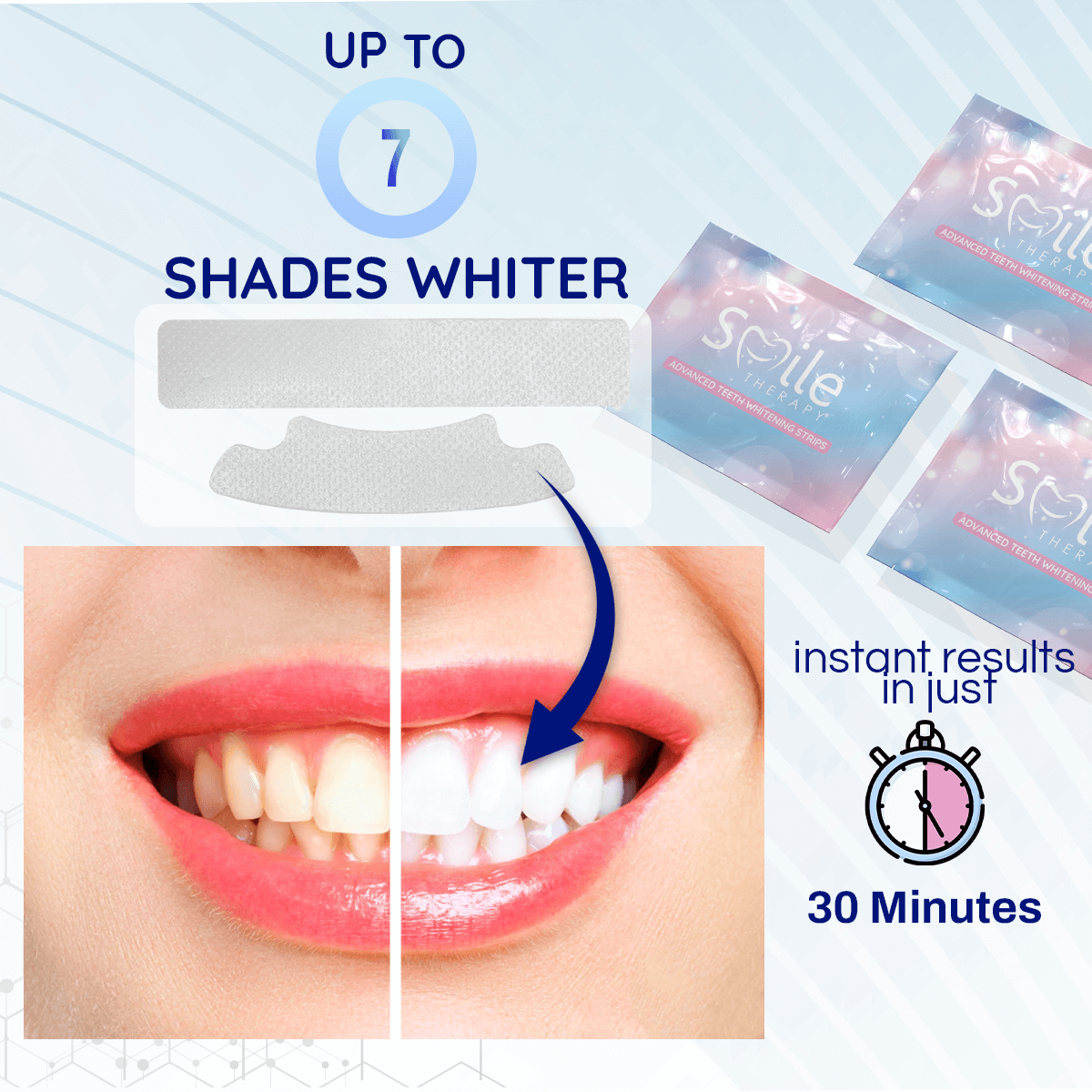 Teeth Whitening Strips | Smile Therapy - Smile Therapy