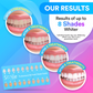 Advanced PAP+ Teeth Whitening Kit DP11