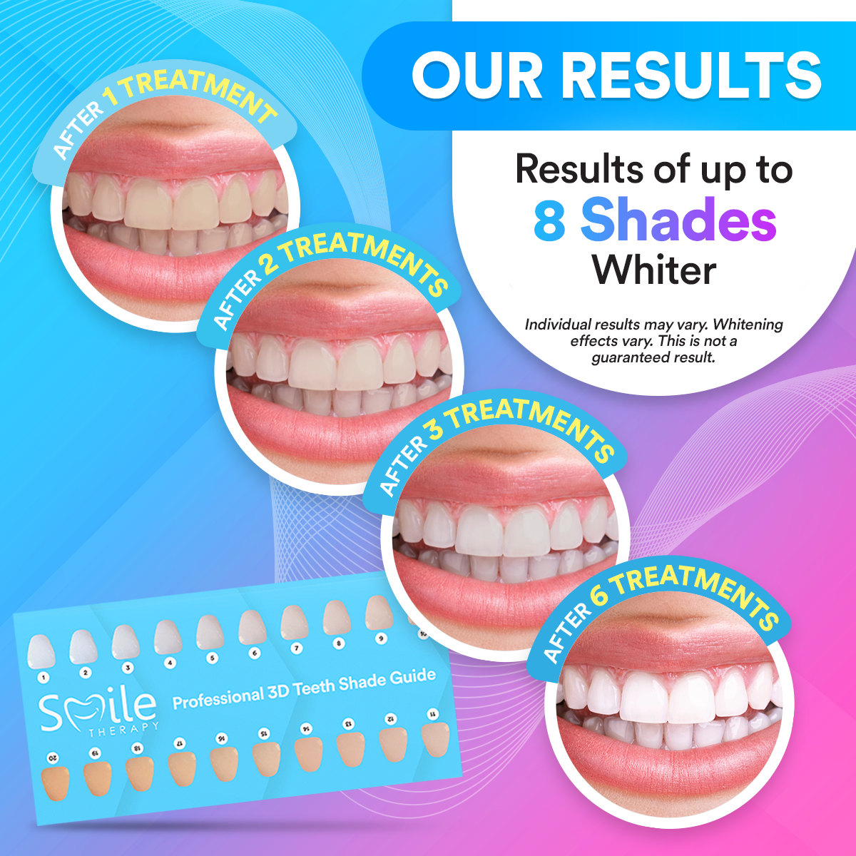Advanced PAP+ At Home Teeth Whitening Kit DP4